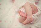 Bebeklerde kalça çıkığı nedir? Tedavisi nasıl olur?